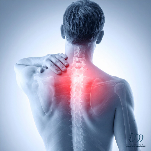 Konya’da Ameliyatsız Boyun Ağrısı ve Boyun Fıtığı Tedavisi