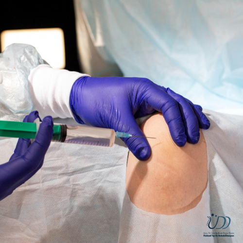 Konya ÜDD Klinik: Nokta Atışı “Eklem İçi Enjeksiyonlar” ile Eklem Ağrılarına Ameliyatsız Çözüm